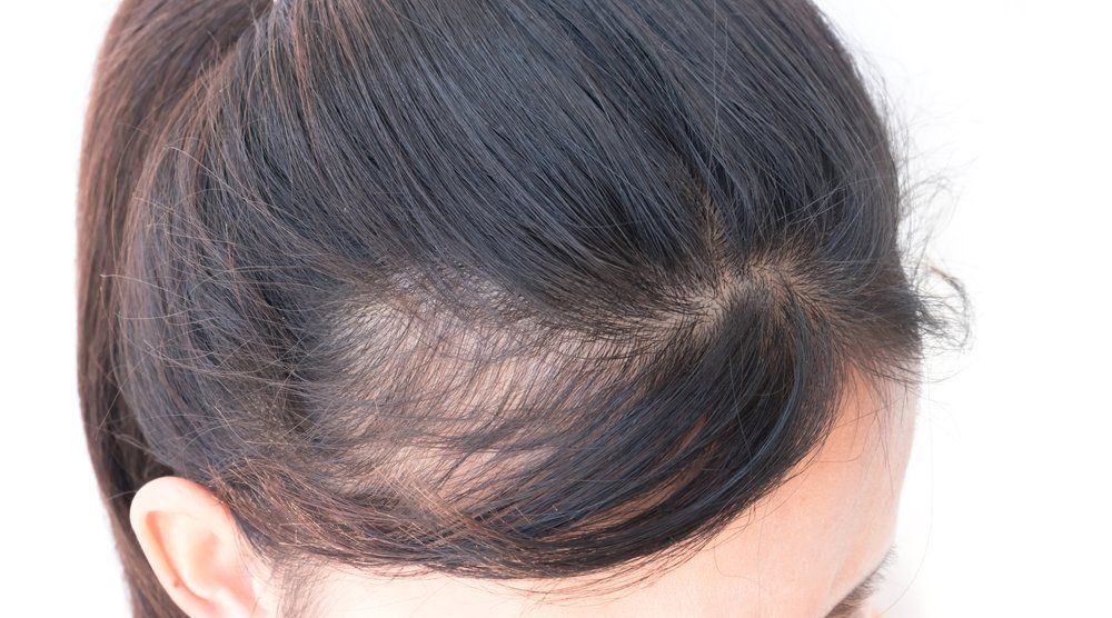 Best Hair Treatment in Mumbai by Dr Debraj Shome at The Esthetic Clinics